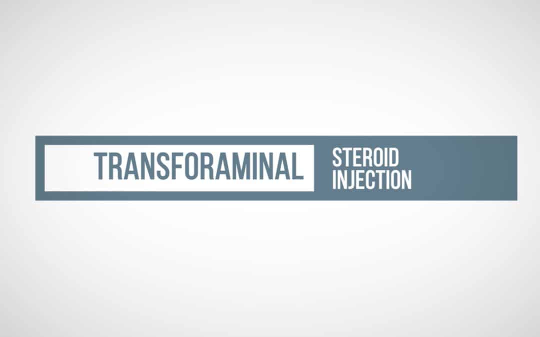 transformial-epidural