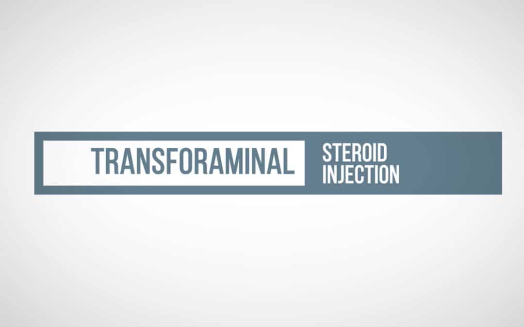 Transformial Epidural