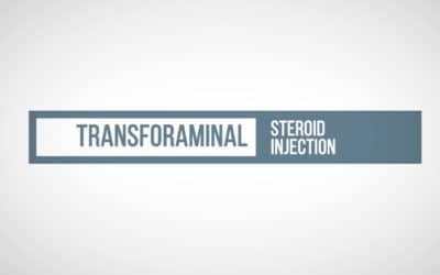Transforaminal Epidural – Video